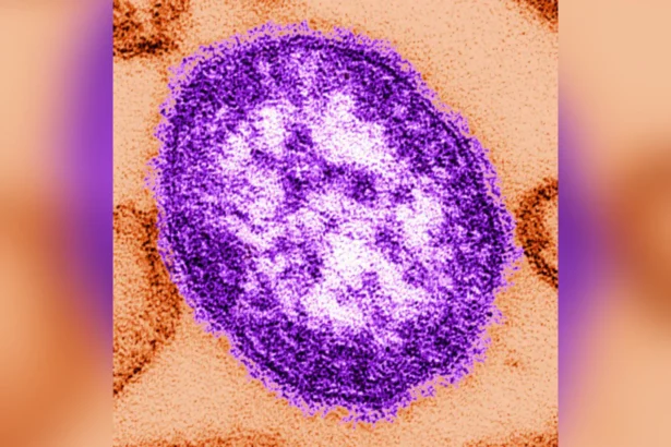 This undated image made available by the Centers for Disease Control and Prevention on Feb. 4, 2015, shows an electron microscope image of a measles virus particle, center. (The Canadian Press/AP-Cynthia Goldsmith/Centers for Disease Control and Prevention via AP)